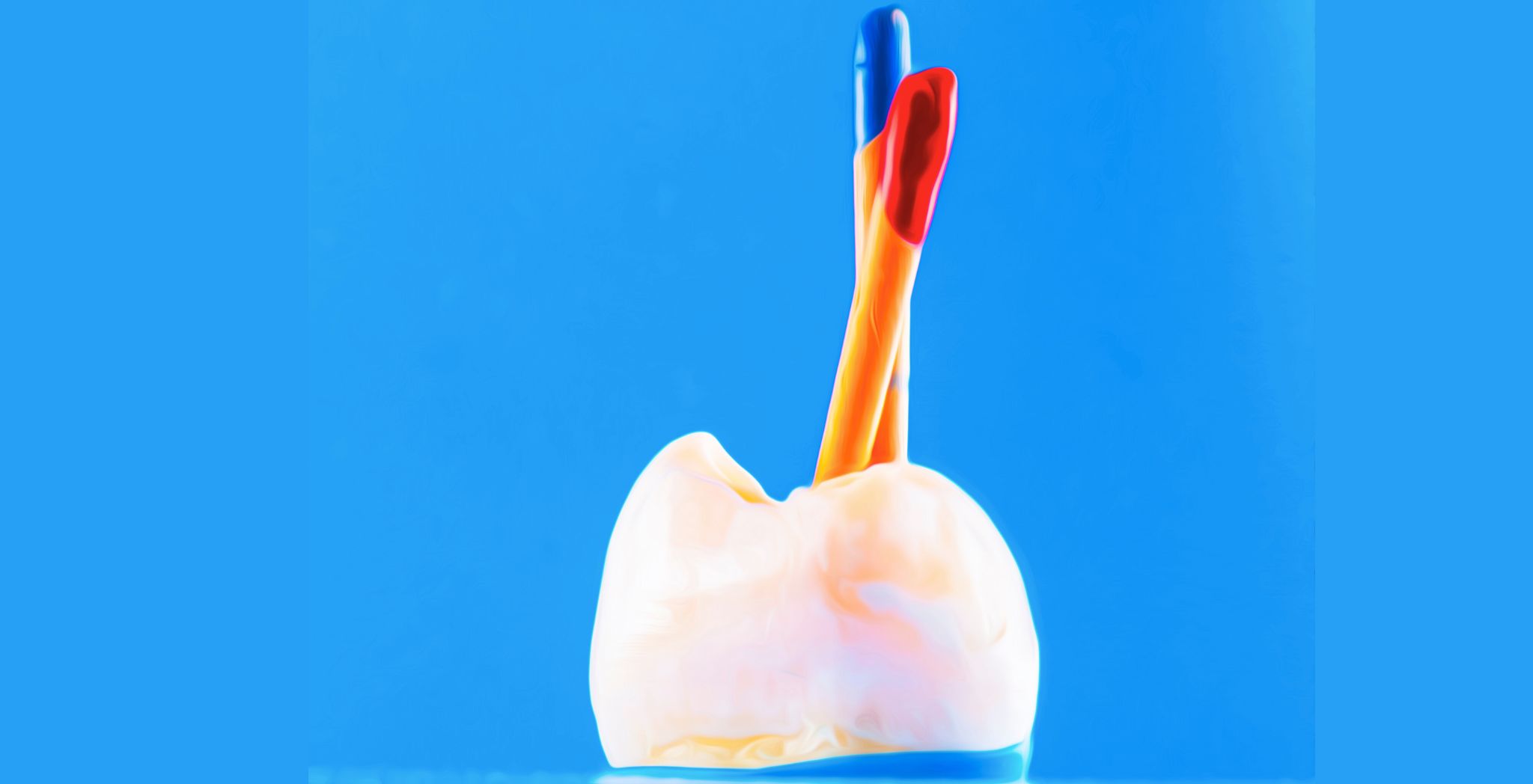 Process of Root Canal, Is a root canal a filling