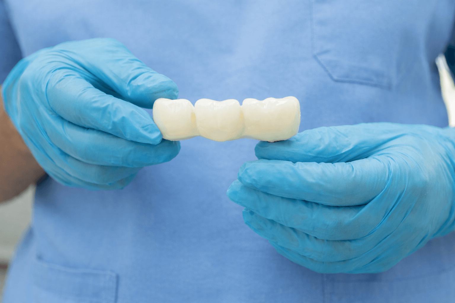 A dentist holding a dental bridge sample