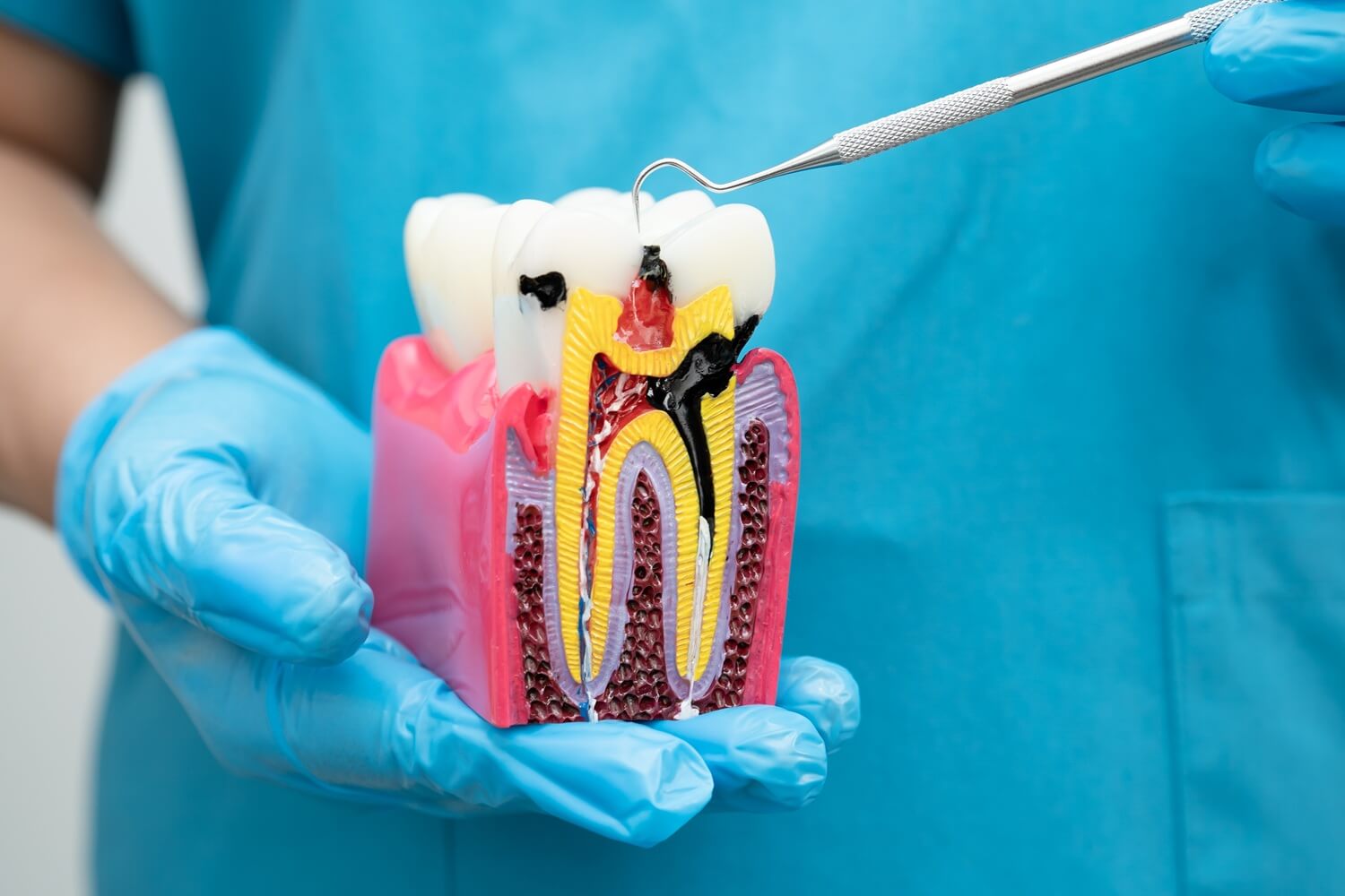 asian dentist holding a tooth model with root canal
