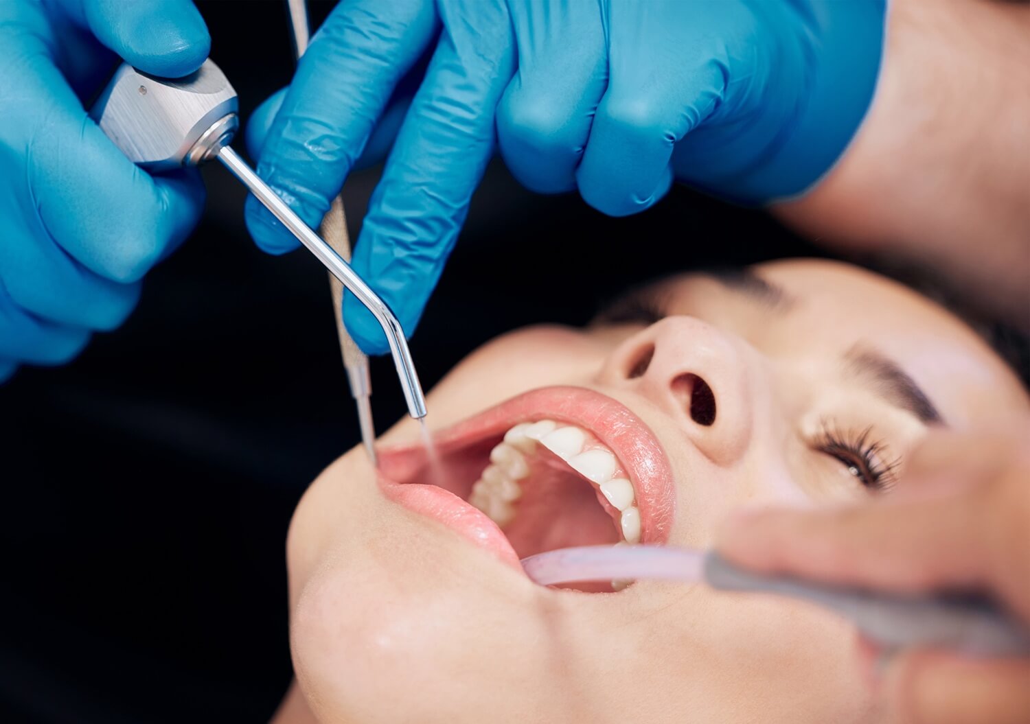 female patient having dental cleaning