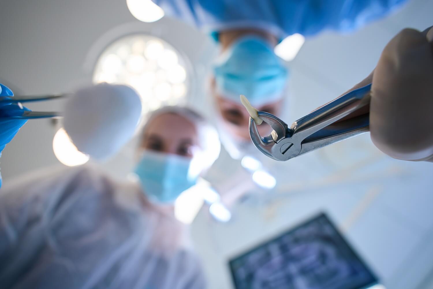 surgeon with special forceps and extracted tooth