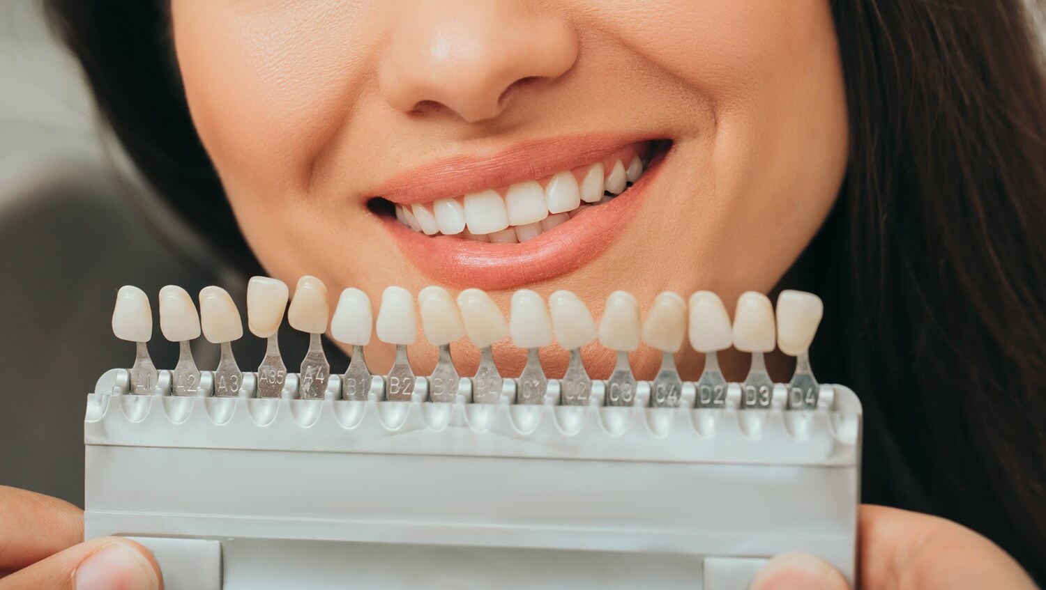 teeth palette for dental veneers