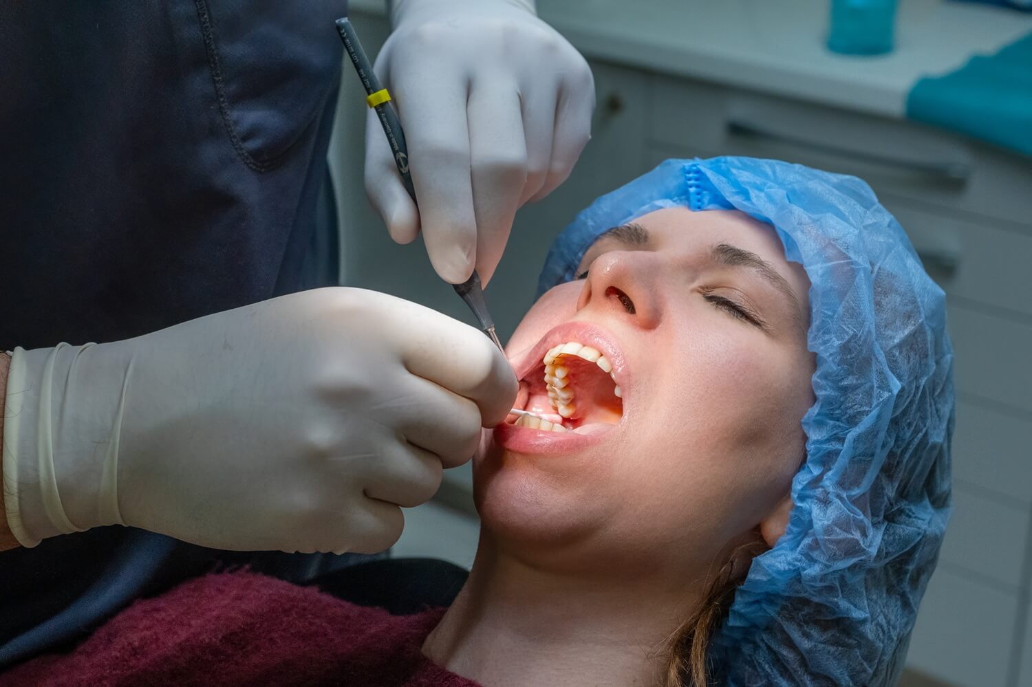 a woman patient having a dental extraction procedure