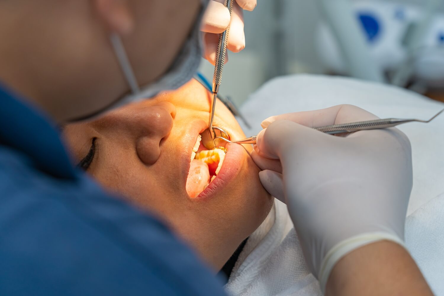 a female dental patient having wisdom tooth checked by a dentist