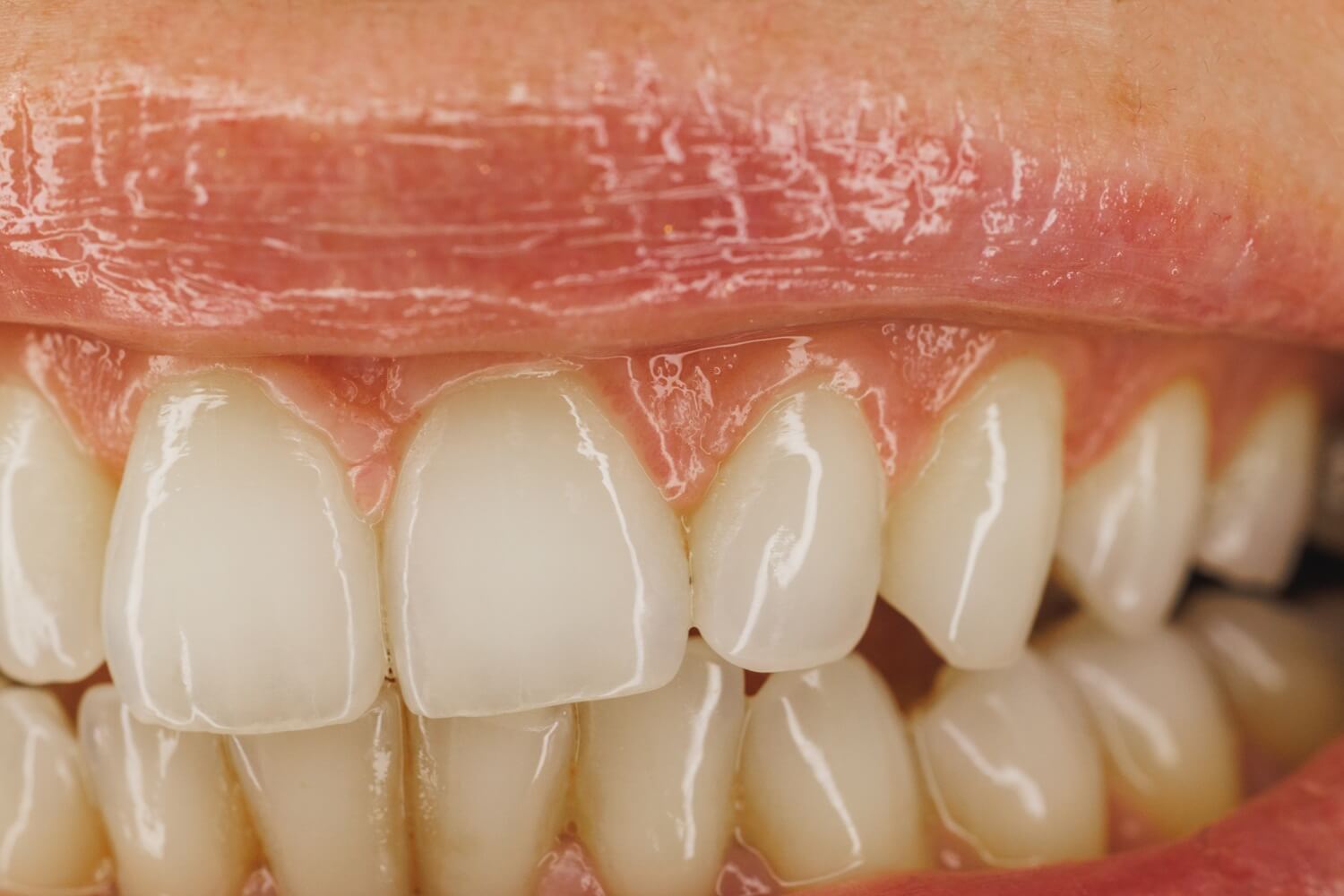 close up of a teeth smiling mouth of a woman