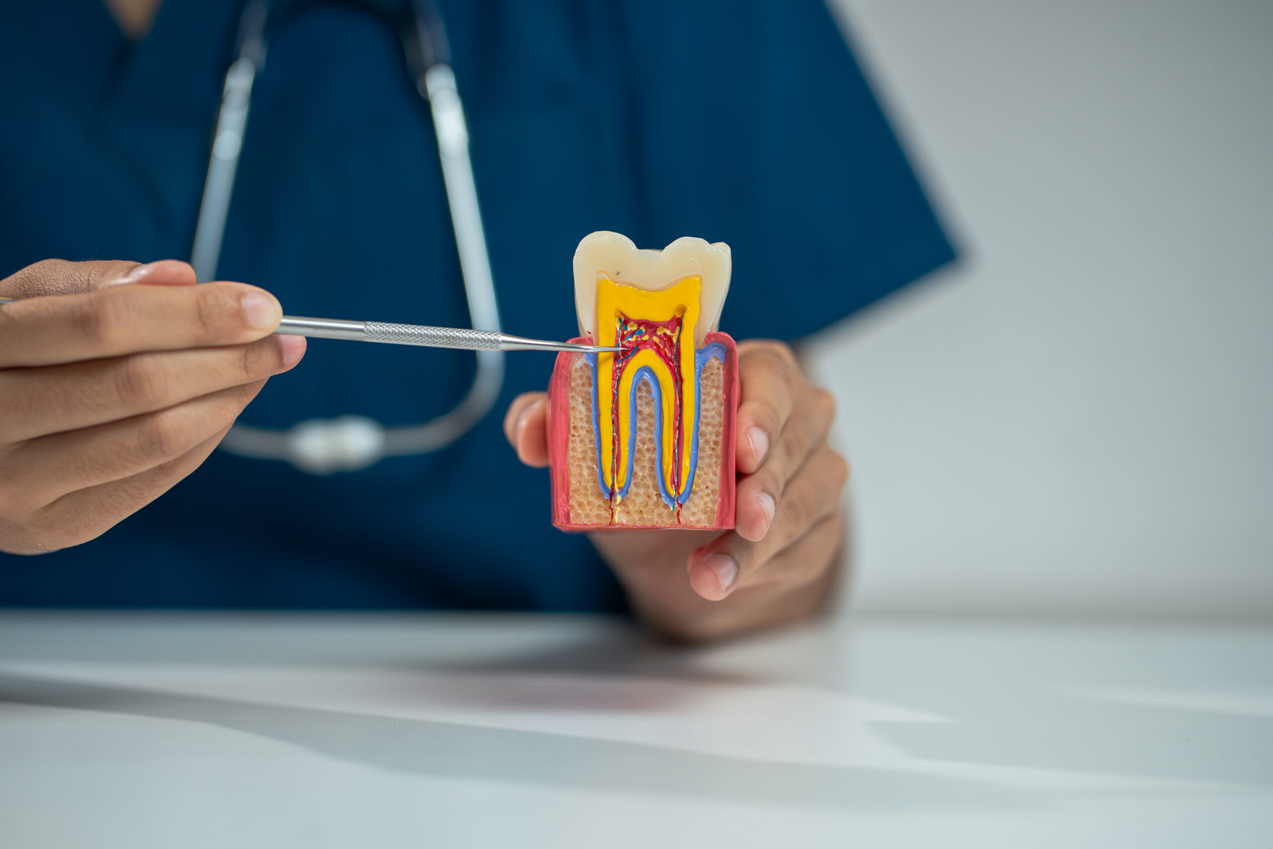 Dental professional using a probe to point to the pulp inside a cross-section tooth model while explaining root canal vs extraction options